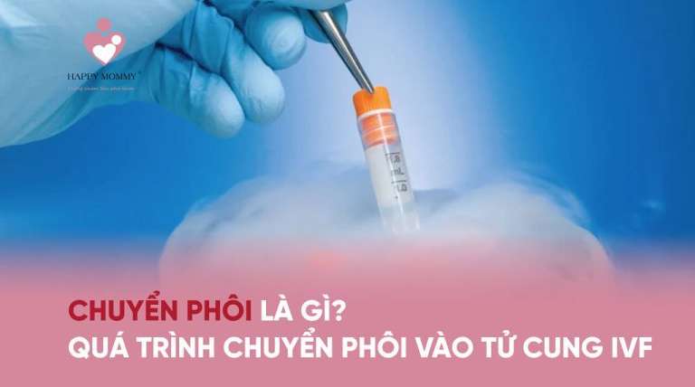 Chuyển phôi là gì? Quá trình chuyển phôi vào tử cung theo phương pháp thụ tinh ống nghiệm IVF