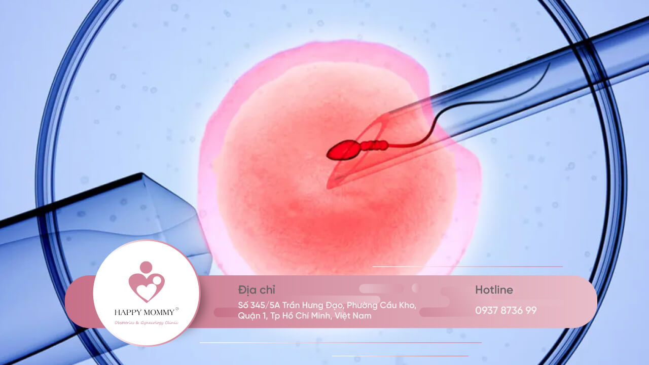 Thụ tinh ống nghiệm là phương pháp mà bác sĩ sẽ lấy trứng của vợ và tinh trùng của chồng đem thụ tinh trong ống nghiệm
