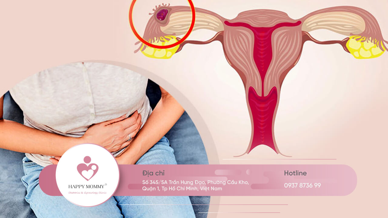 Xét nghiệm HCG là một trong những yếu tố cho biết tình trạng thai ngoài tử cung