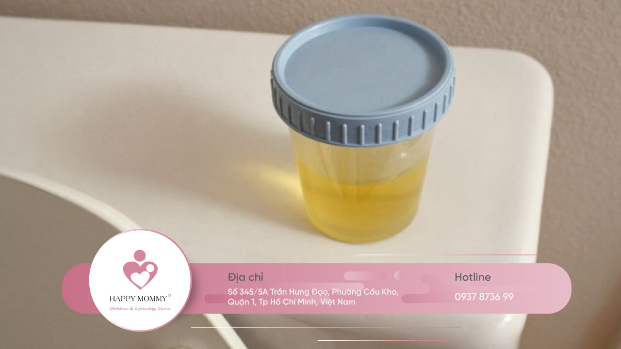 Phương pháp xét nghiệm nồng độ HCG phổ biến nhất là xét nghiệm bằng nước tiểu