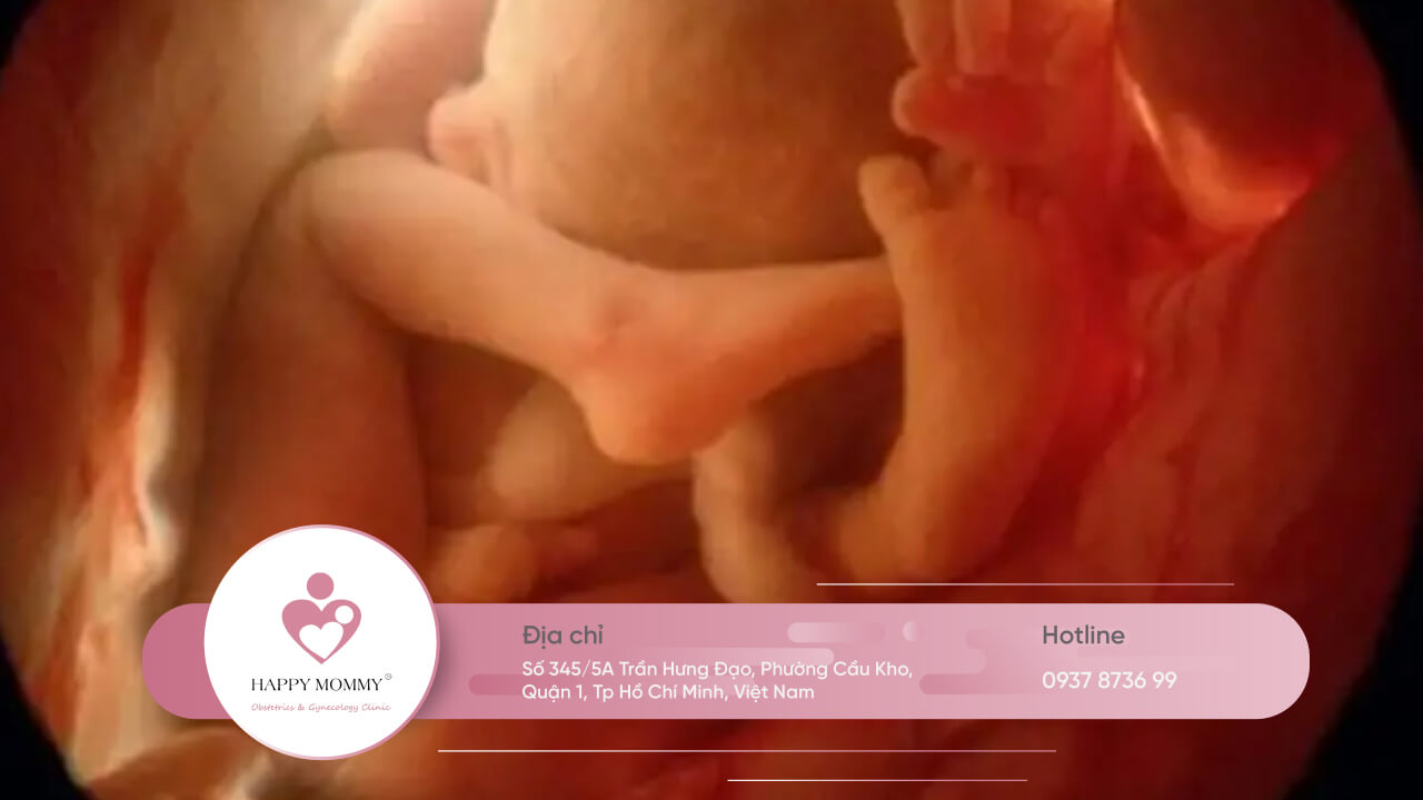 Hình ảnh siêu âm 4D thai nhi 12 tuần tuổi