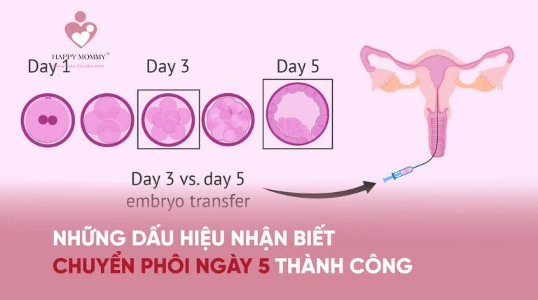 Những dấu hiệu chuyển phôi ngày 5 thành công