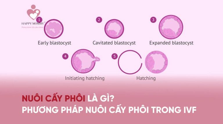 Nuôi cấy phôi là gì? Phương pháp nuôi cấy phôi trong IVF