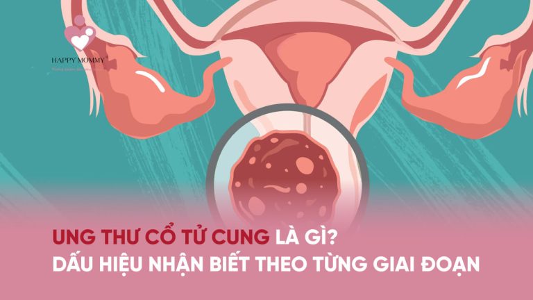 Ung thư cổ tử cung là gì? Dấu hiệu ung thư cổ tử cung theo từng giai đoạn bệnh