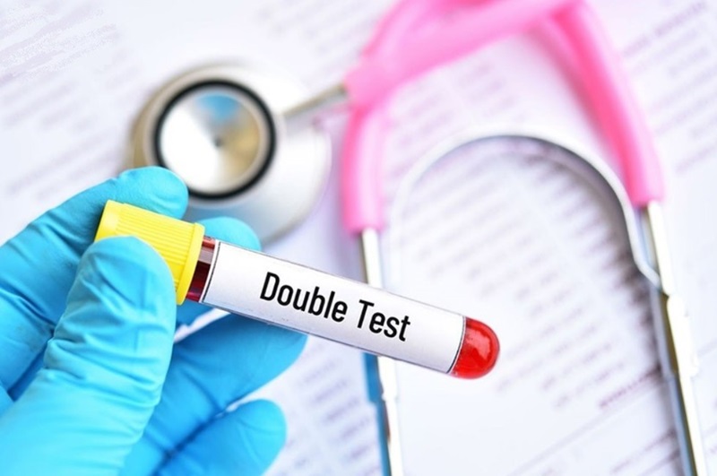 Mất từ 2 – 3 ngày để đánh giá kết quả xét nghiệm Double Test