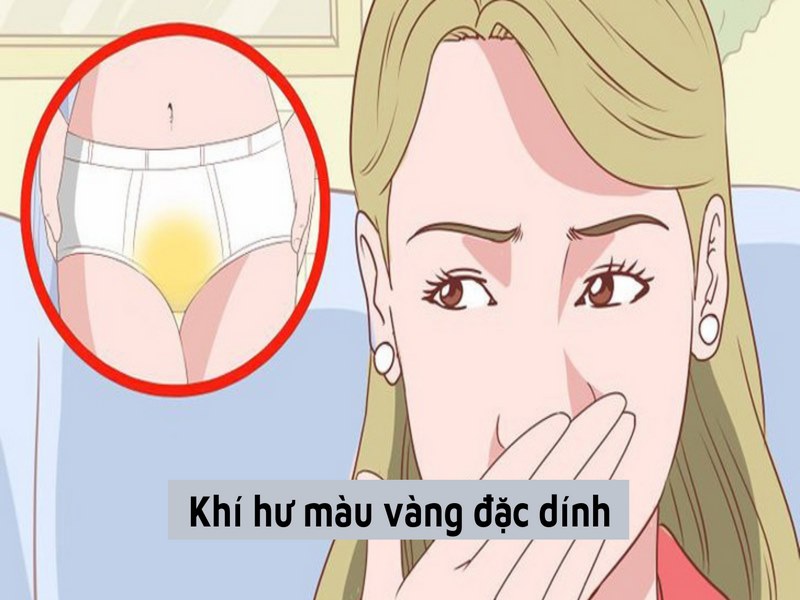 Một số vấn đề lưu ý khi gặp tình trạng vùng kín ra dịch màu vàng