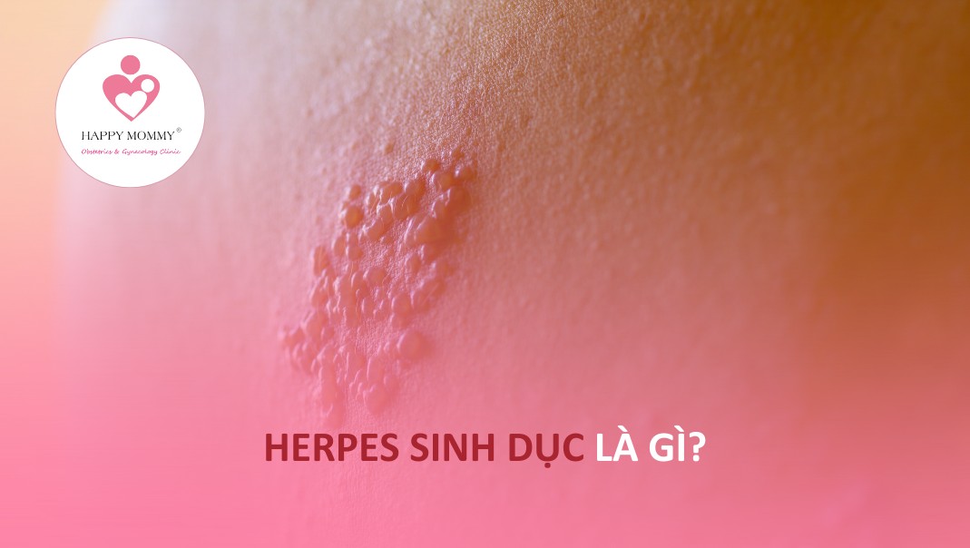 Herpes sinh dục